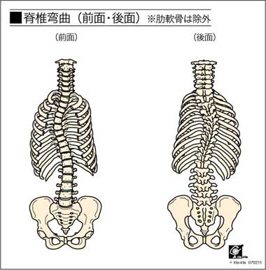 授乳や抱っこで腰 背中 肩 首 腕に痛みと痺れがあり寝屋川市から整体 カイロプラクティックに来院