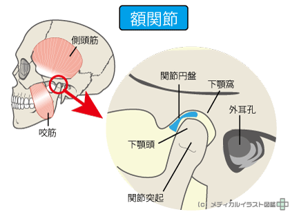 口が開かない　治療　尼崎市